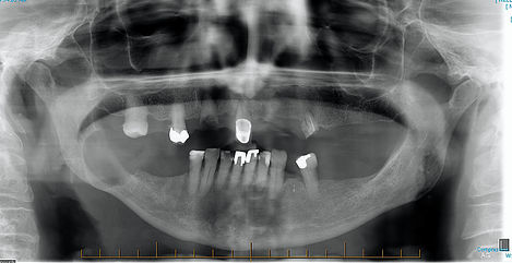 Surgery from Celeb Jaws Health